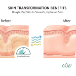 Moisture Lotion-120ml