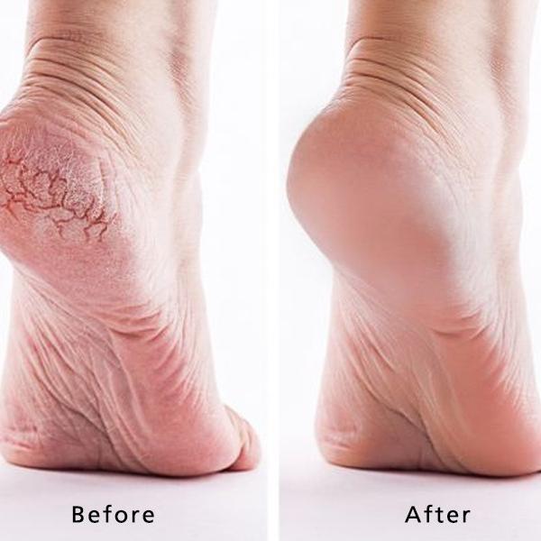 Exfoliating Foot Mask 2 Pair